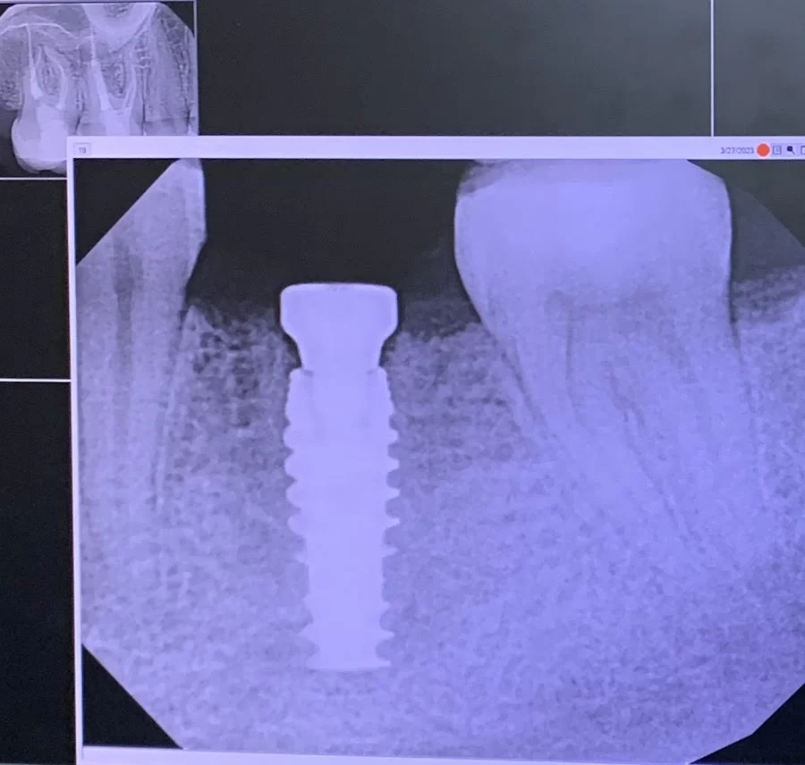 Triangle Periodontics 2