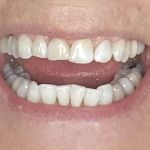 Glamm Dentistry