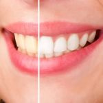 Bellevue Dental Care