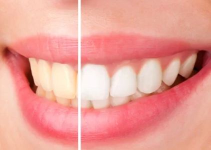 Bellevue Dental Care