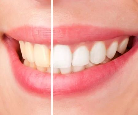 Bellevue Dental Care