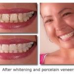 Cary Implant and General Dentistry