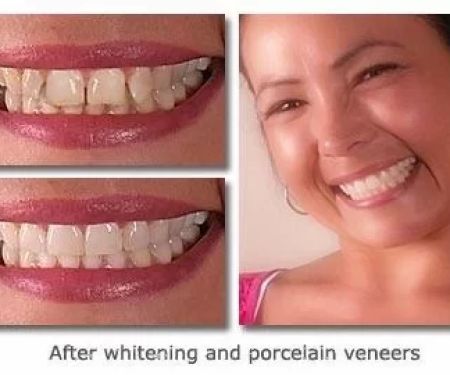 Cary Implant and General Dentistry