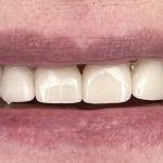 West Nashville Dental