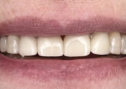 West Nashville Dental