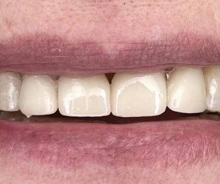 West Nashville Dental