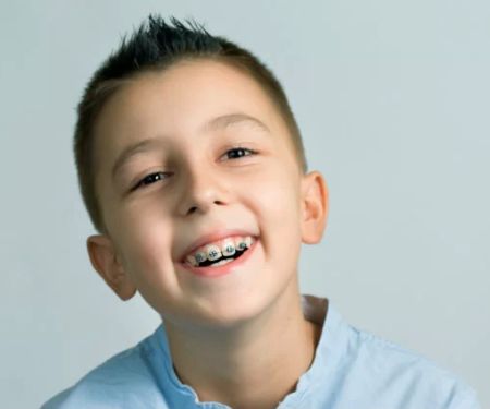 BLACKER ORTHODONTICS, INVISALIGN, Braces Chandler, Board Certified, Children & Adult