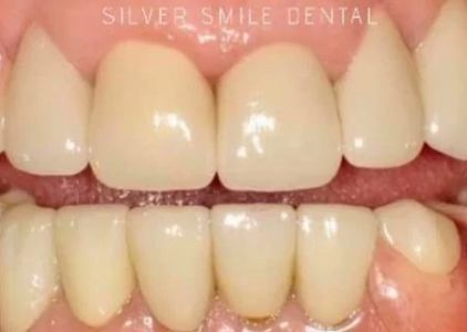 Artistic Dentistry - Chandler