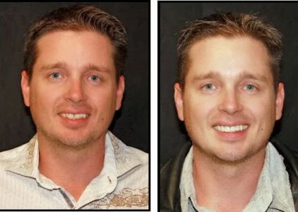 Intermountain Smiles
