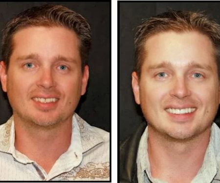 Intermountain Smiles
