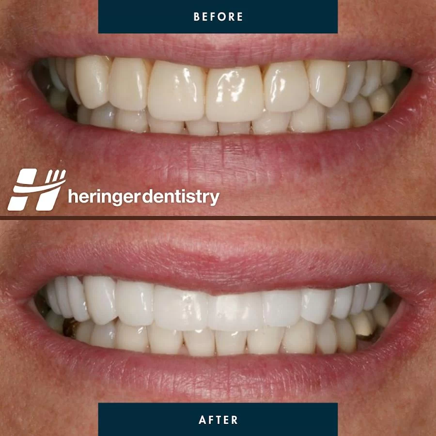 Heringer Dentistry LLC 10