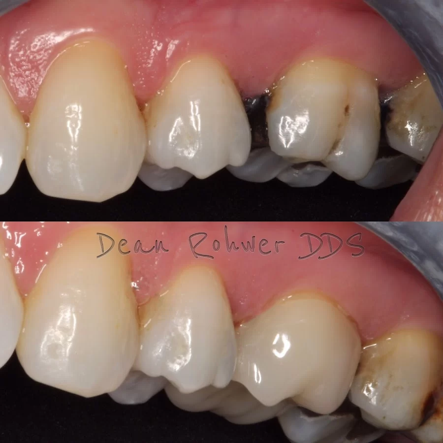 Dean Rohwer DDS 4