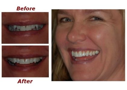 Jeffrey A. Hill, DDS