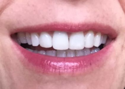 Creekstone Dental