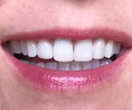 Creekstone Dental