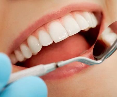 Kay A. Van Erem, DDS