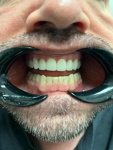 Chandler Dentist | Brigham D Baker DDS 1