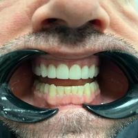 Chandler Dentist | Brigham D Baker DDS ico