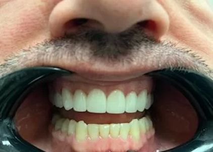 Chandler Dentist | Brigham D Baker DDS