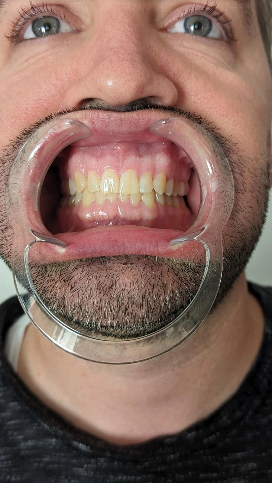 Chandler Dentist | Brigham D Baker DDS 9