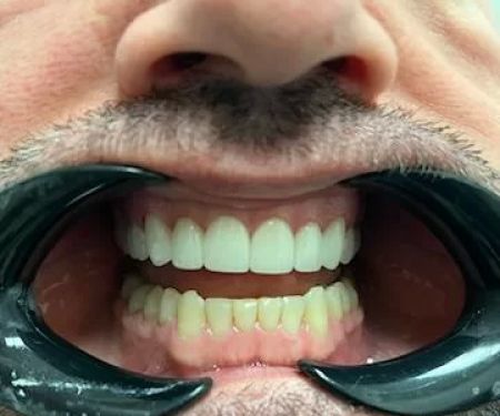 Impressions Dental | Chandler Dentist