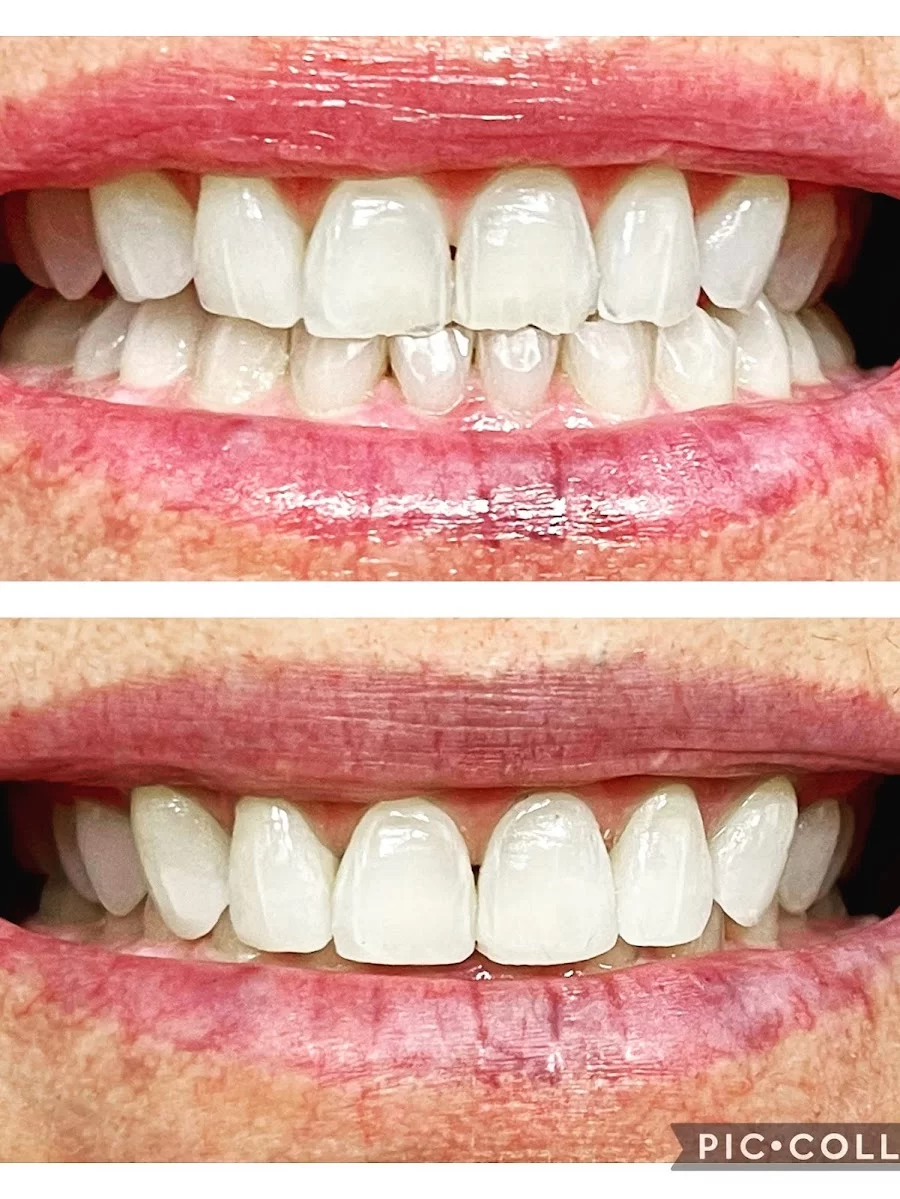 Bellissimo Dentistry & Implant Center Picture 5