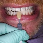 Promenade Dental Care