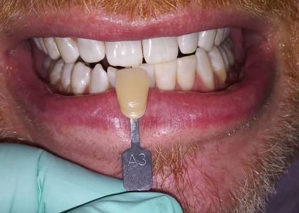Promenade Dental Care