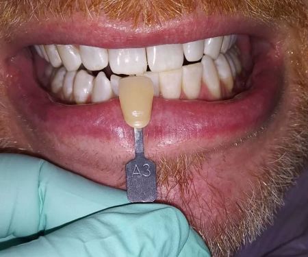 Promenade Dental Care