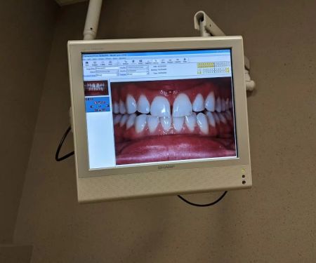 Dr. Robert V. Schmidt, DDS