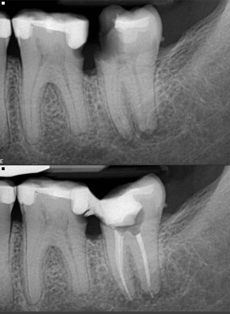 State Endodontics 1