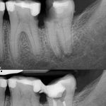 State Endodontics