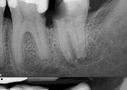 State Endodontics