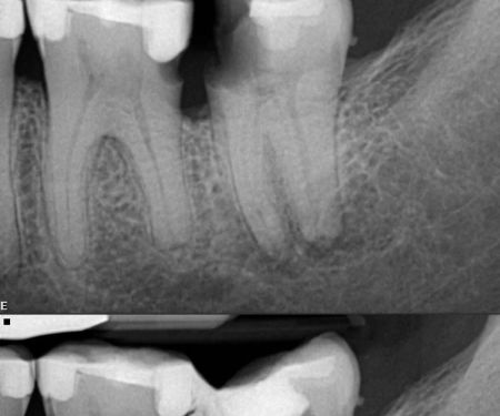 State Endodontics