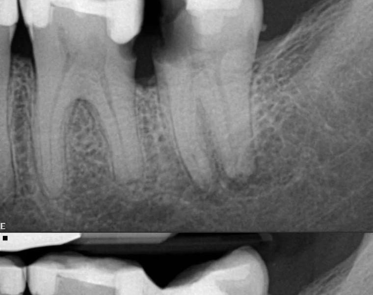 State Endodontics