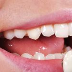 Orchard Meadows Family Dental & Denture Clinic