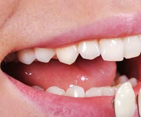 Orchard Meadows Family Dental & Denture Clinic