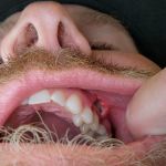 Dr. Bart B. Morrison, DDS