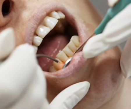 Rapid City Smiles: Implant & Family Dentistry