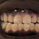 Petersburg Family Dental