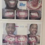 Ji Orthodontics