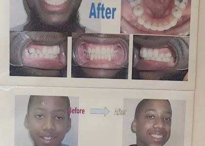 Ji Orthodontics