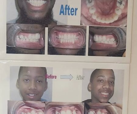 Ji Orthodontics