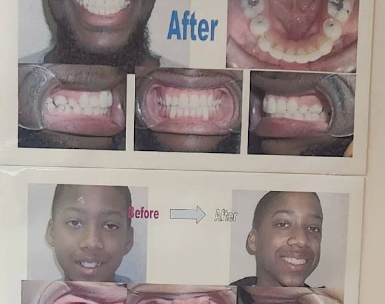 Ji Orthodontics