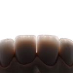 Fuller Smiles - Dentist - Long Beach
