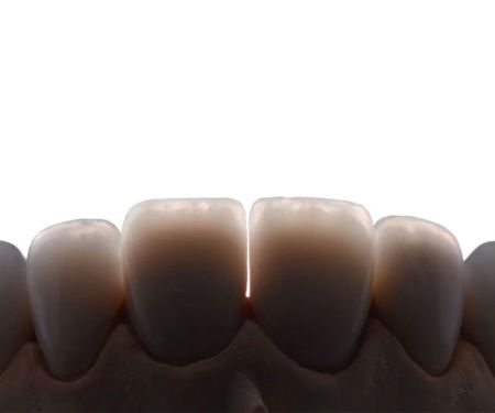 Fuller Smiles - Dentist - Long Beach