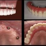 California Smile Dental Group