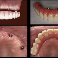 California Smile Dental Group ico