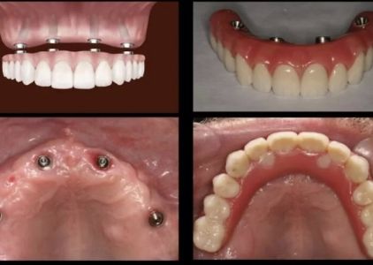 California Smile Dental Group