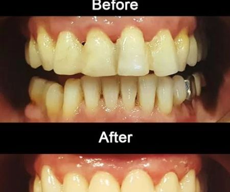 Anaheim Dental Group